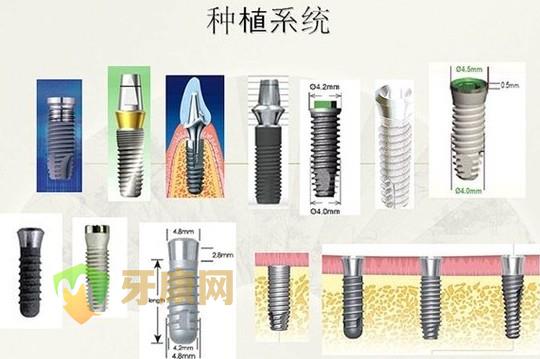 常用的四种种植系统及其特点介绍