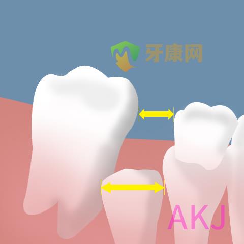 长多生牙