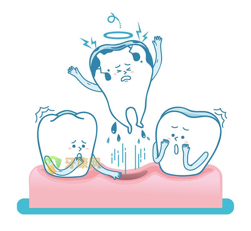 牙齿松动