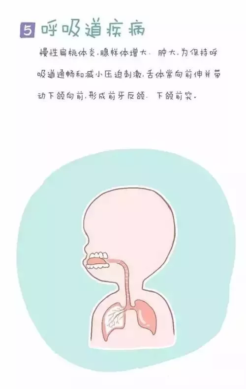 孩子地包天？家长可能忽视了这些问题！