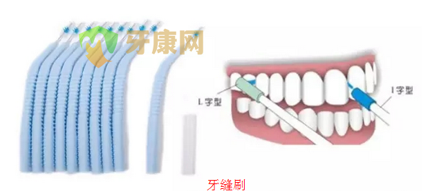 正畸牙缝刷多久换一次