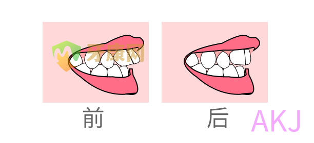 矫正前后