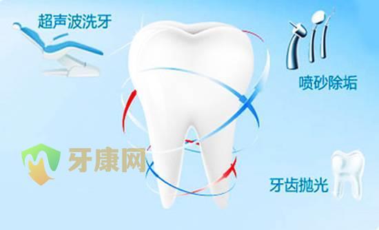 洗牙真的是毁牙齿么?来给洗牙辟谣!