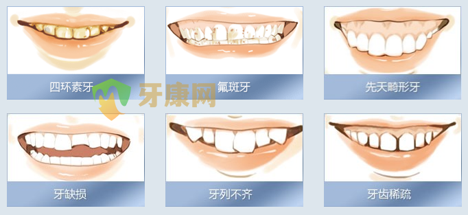 牙康网西诺德全瓷牙适用人群