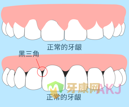 牙齿松动