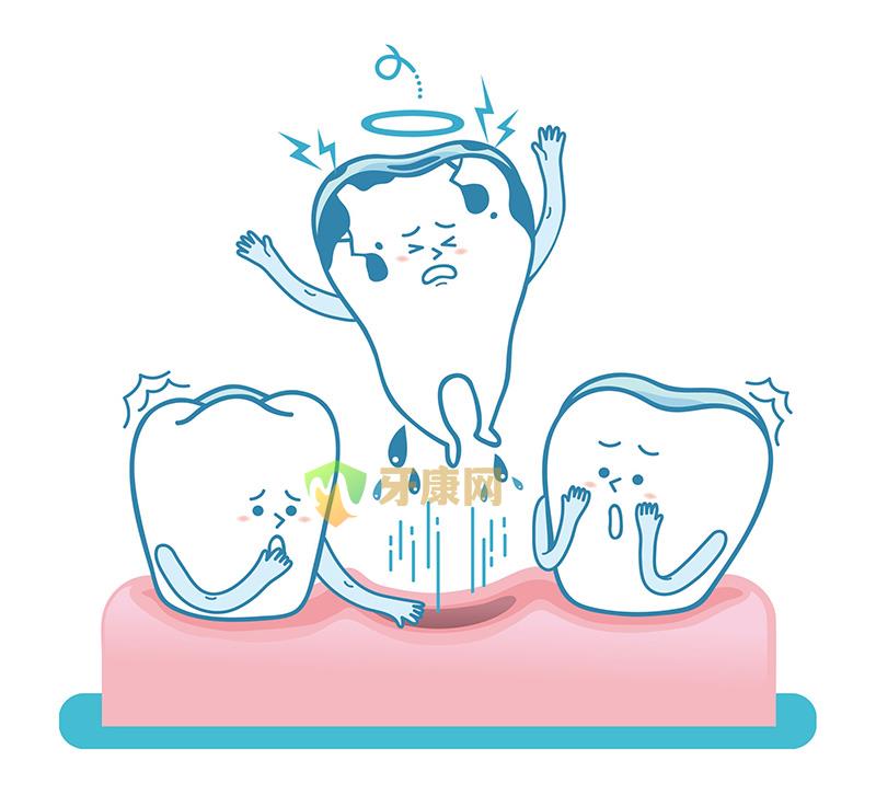 牙齿松动