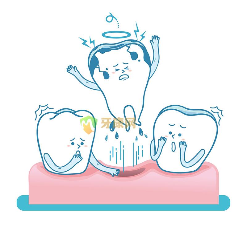 牙齿松动