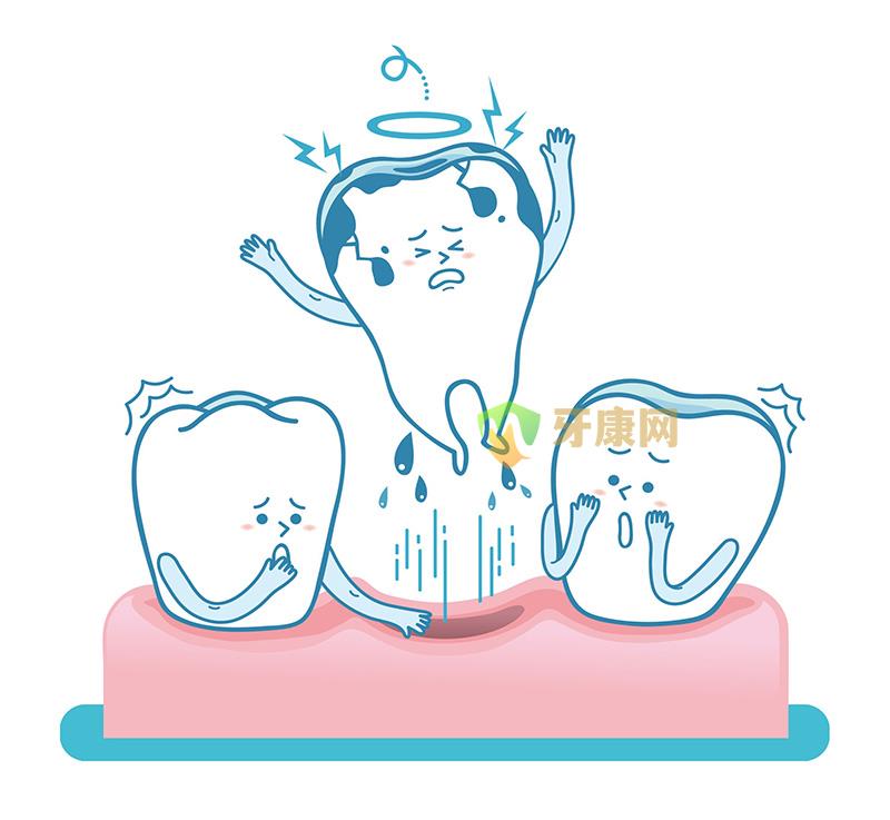 牙齿松动