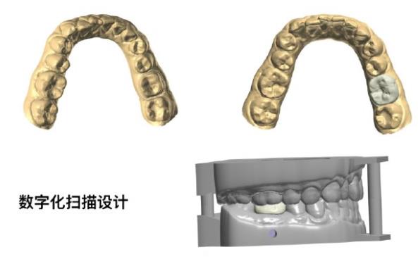 数字化扫描