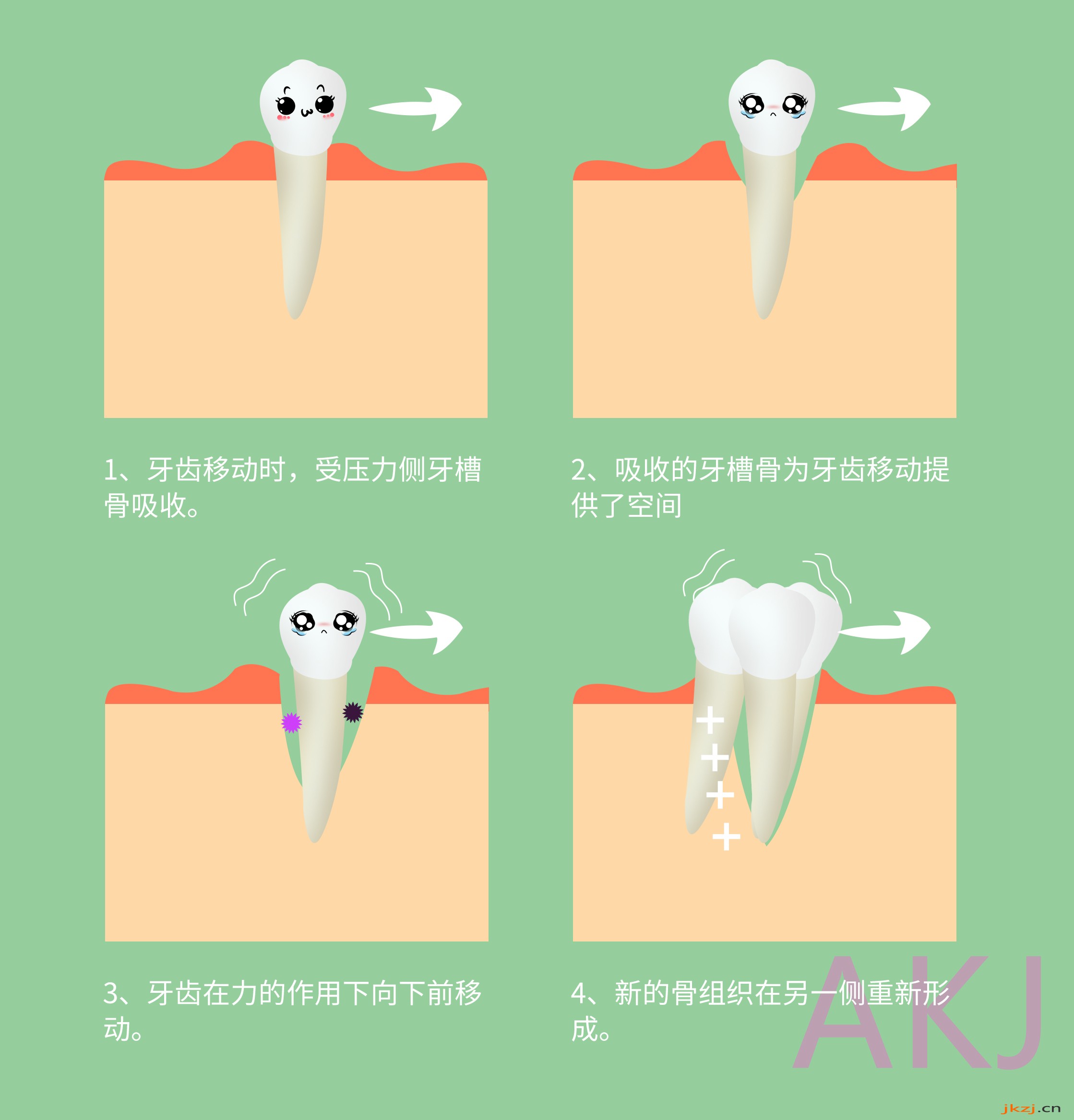 牙齿矫正过程