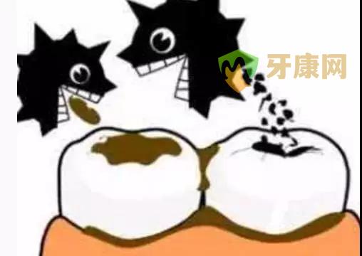 乳牙龋齿治疗