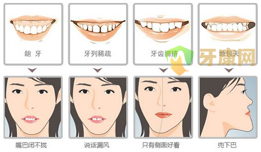 孩子牙齿矫正较佳年龄