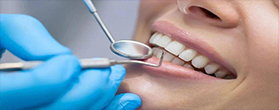 牙康网-专家谈补牙镶牙
